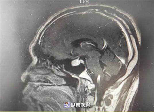 揭秘鼻子奥秘及其重要性新发现